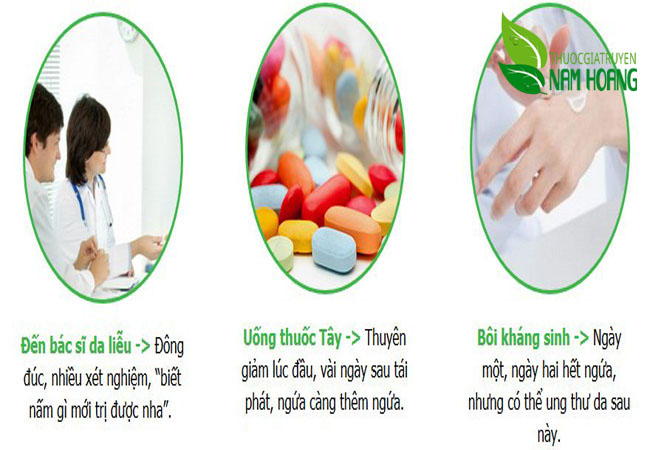 Thuốc đặc trị nấm da tốt nhất đang được nhiều người tìm mua